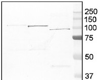 GP | Glycogen phosphorylase in the group Antibodies Human Cell Biology / Other proteins at Agrisera AB (Antibodies for research) (AS09 455)